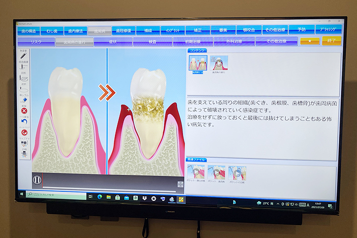  説明用ツール